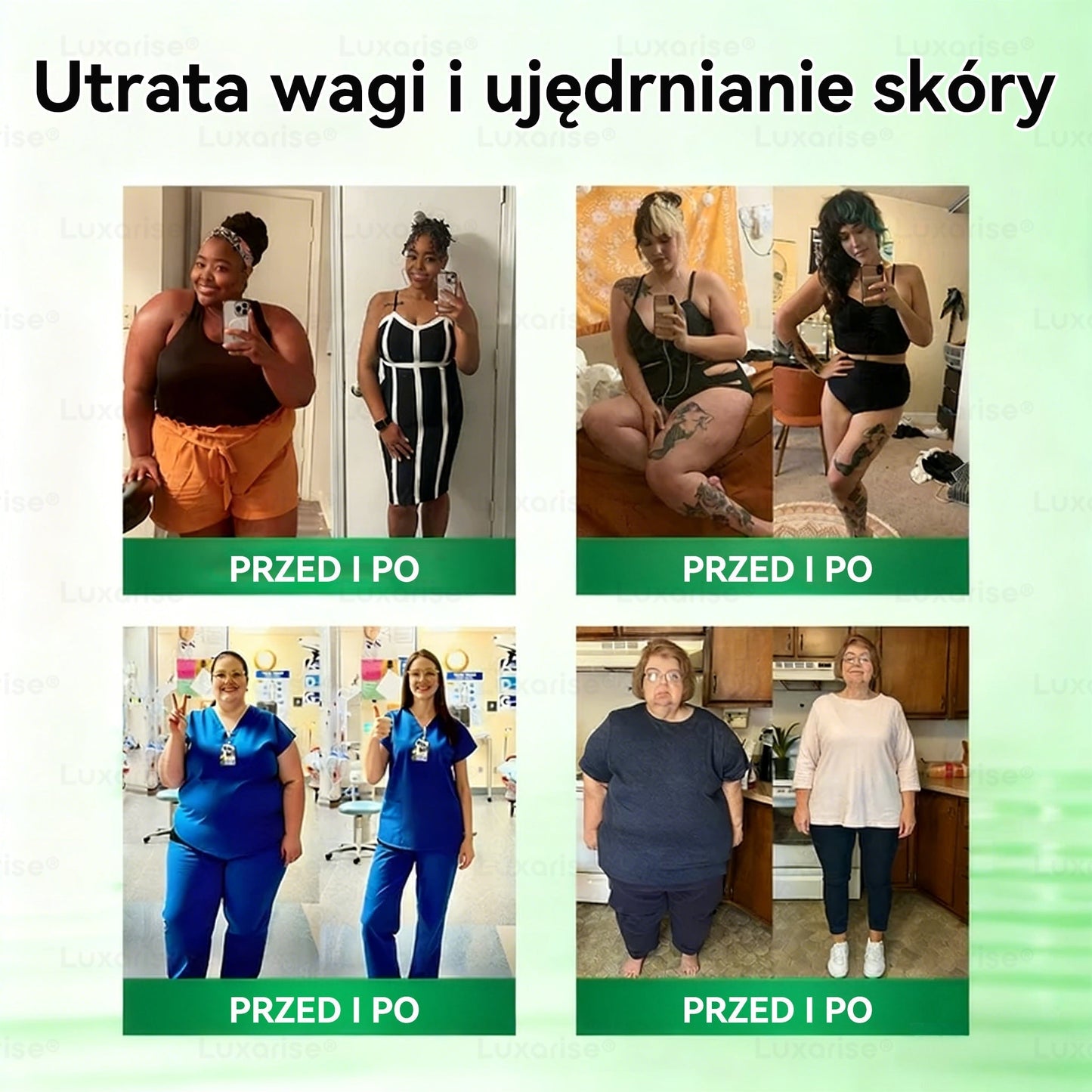 Oficjalny sklep| 👩‍⚕️𝗟𝘂𝘅𝗮𝗿𝗶𝘀𝗲® MORINGA Z BERBERYNA 10W1 Zaawansowany Nano-Mikroigłowy Plaster (Stosować raz na dobę, zauważalne efekty w ciągu 7 dni) ✅ Otyłość, cukrzyca, bezdech senny oraz schorzenia stawó💥